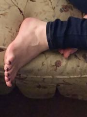 Photo 5, Gf feet (Feet